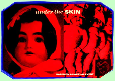 Under the Skin